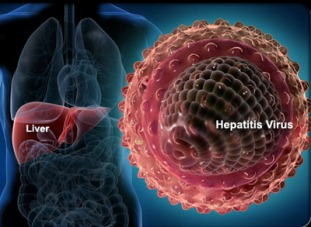 Obat Hepatitis Ampuh dan Aman
